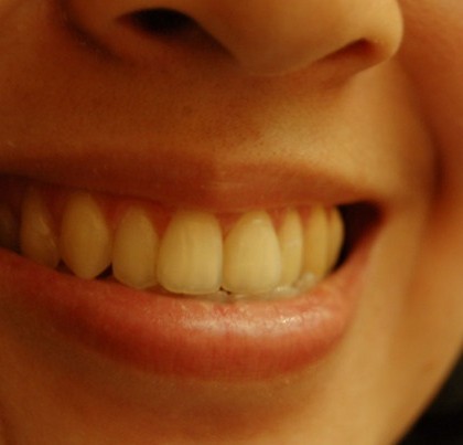 Uśmiechnięta kobieta pokazująca zęby